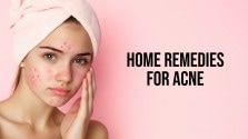 home remedies for acne