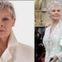 Judi Dench suffers age related macular degeneration