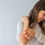 Woman dealing with psoriasis