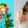 healthy diet for psoriasis