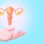 All about uterine fibroids